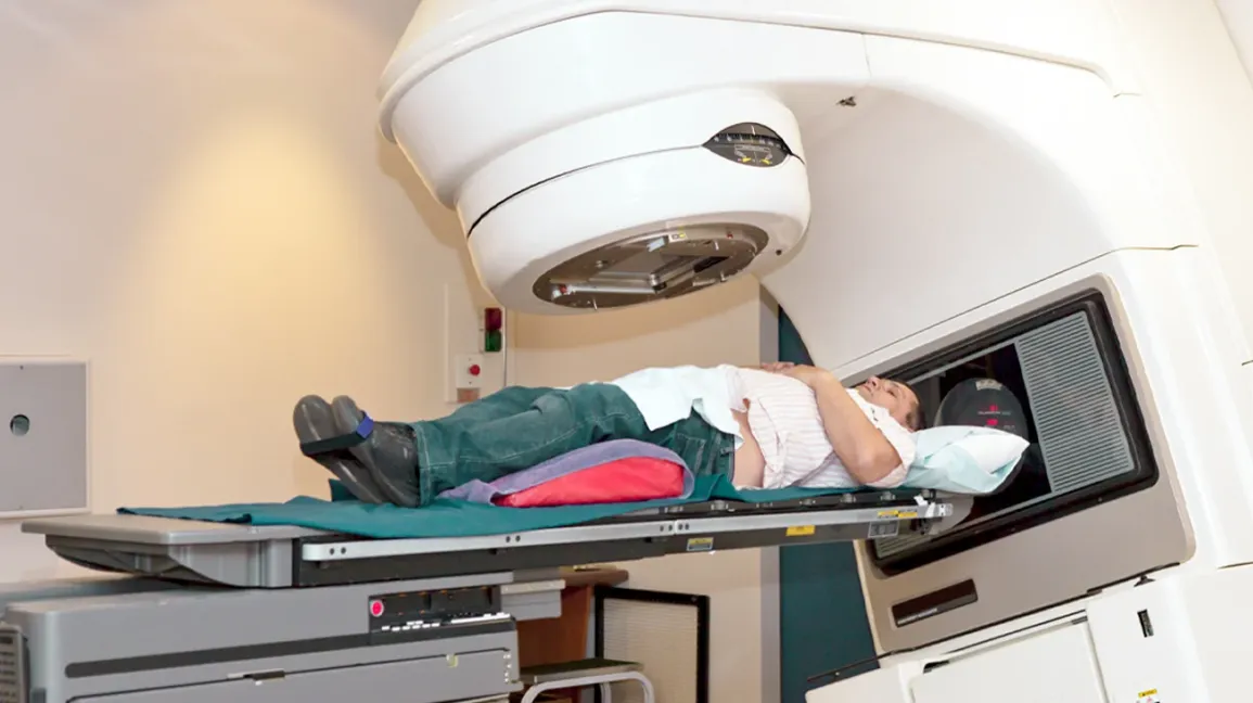 Patient positioned under a linear accelerator in a radiotherapy suite